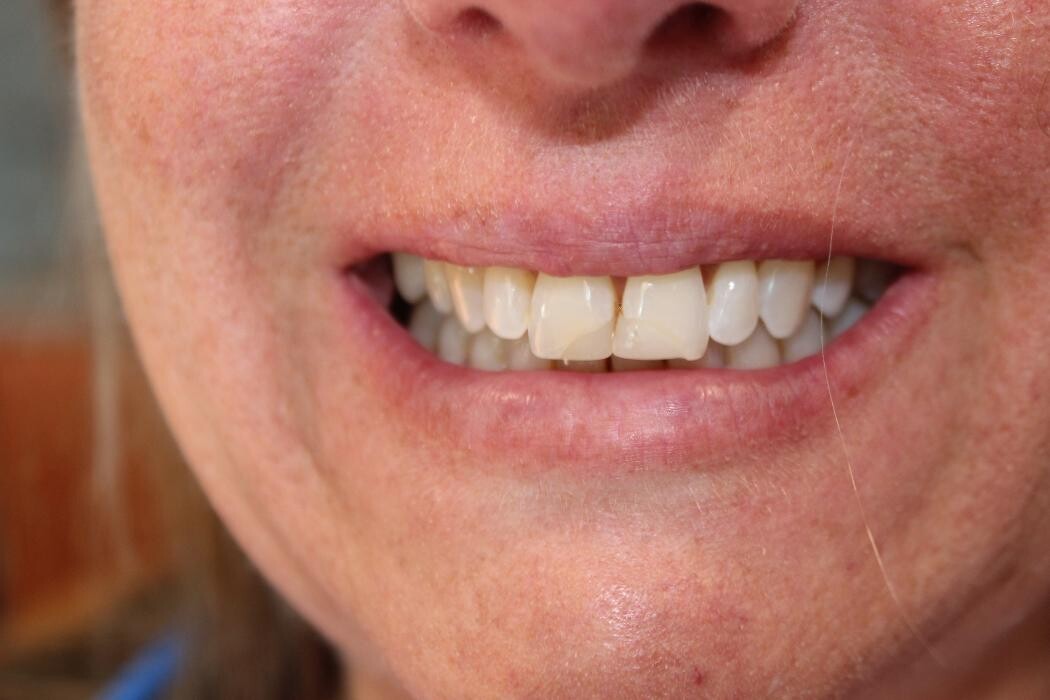 Images Hamilton Family Dentistry