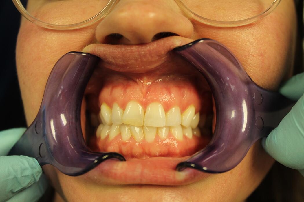 Images Hamilton Family Dentistry