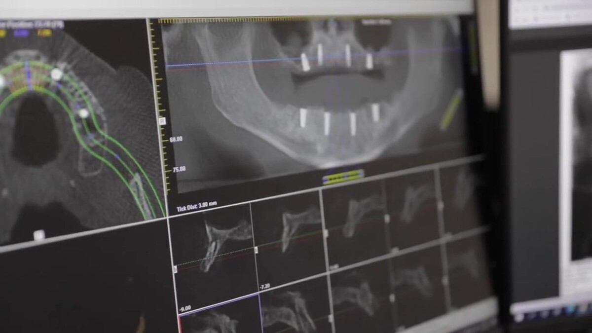 Images Live Oak Oral Surgery of Texas