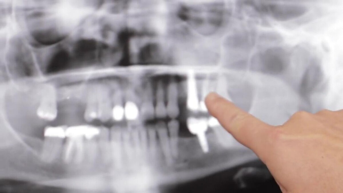 Images Live Oak Oral Surgery of Texas