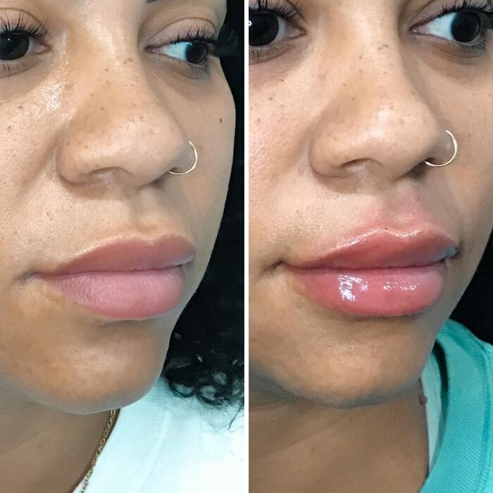 Images Livio Med Spa