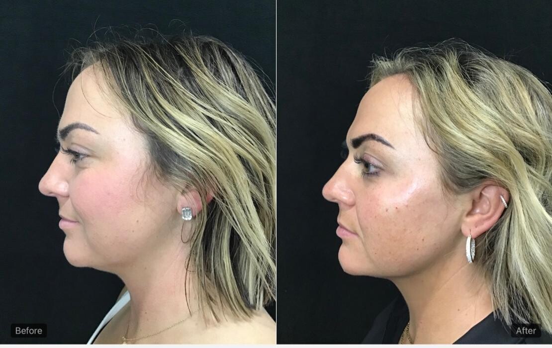 Images Livio Med Spa