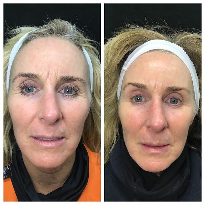 Images Livio Med Spa