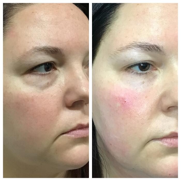 Images Livio Med Spa