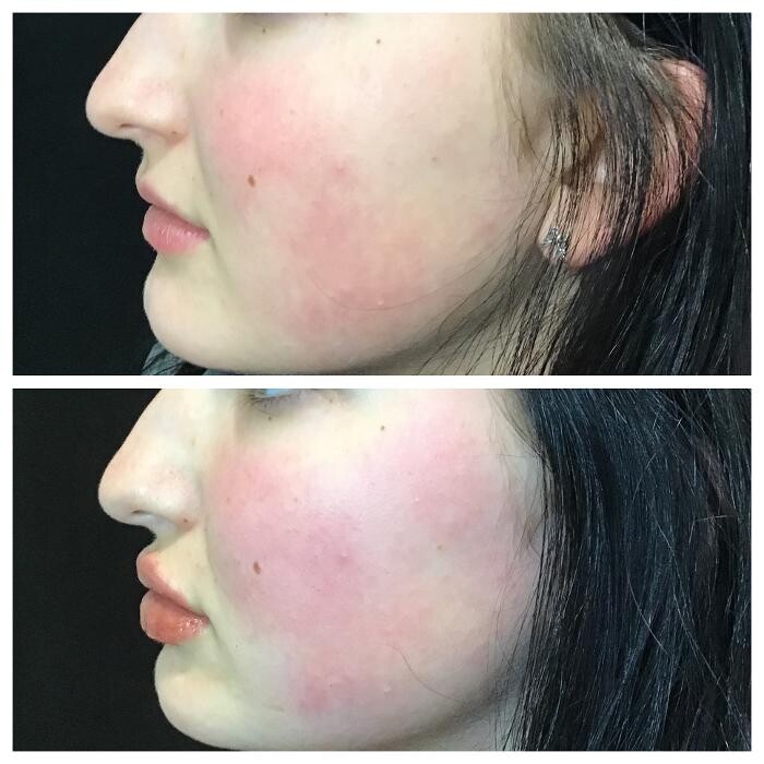 Images Livio Med Spa