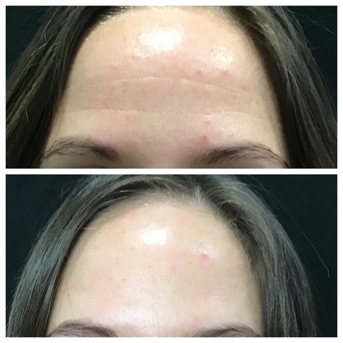 Images Livio Med Spa