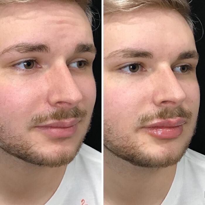 Images Livio Med Spa