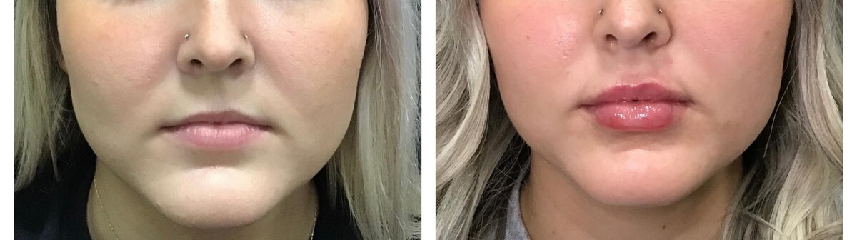 Images Livio Med Spa