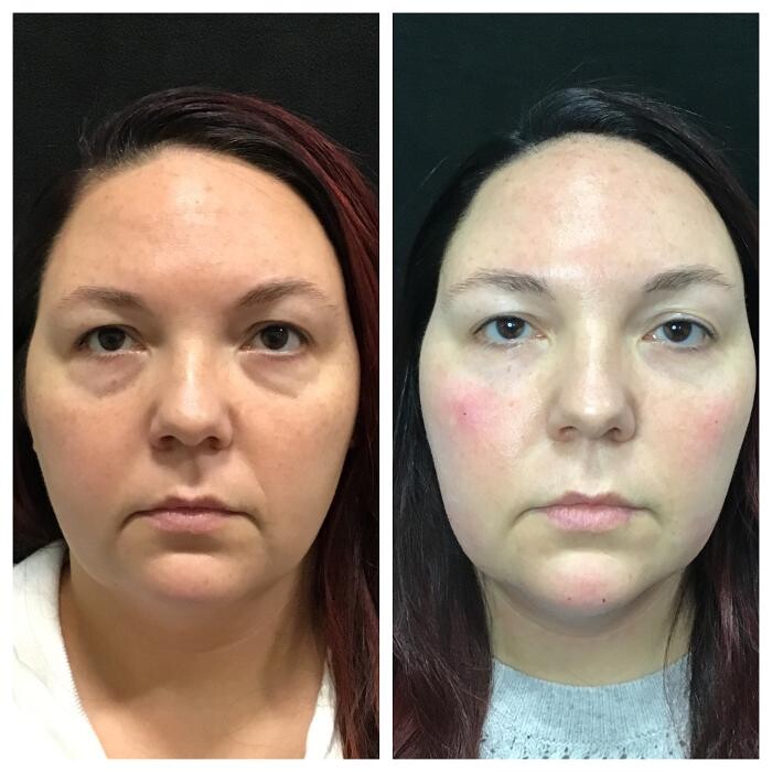 Images Livio Med Spa