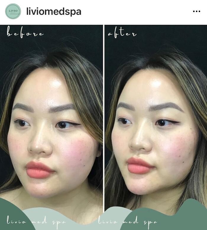 Images Livio Med Spa