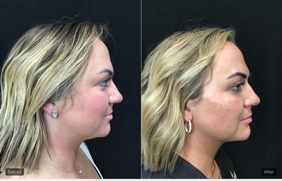 Images Livio Med Spa