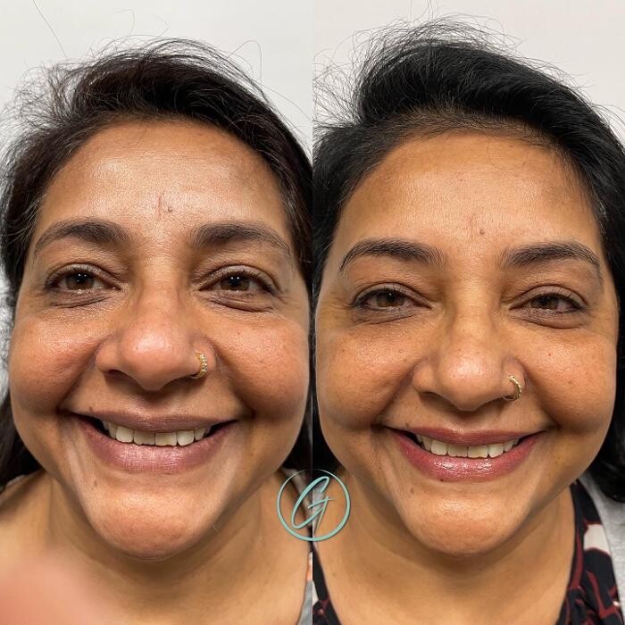 Images Georgous Aesthetic Bar