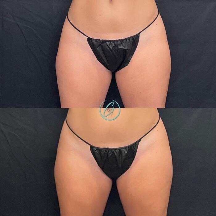 Images Georgous Aesthetic Bar