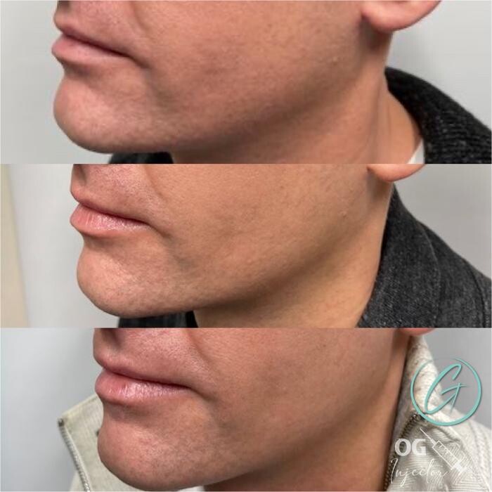 Images Georgous Aesthetic Bar