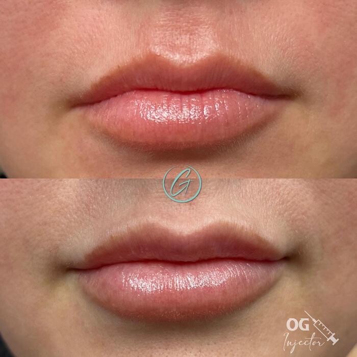 Images Georgous Aesthetic Bar