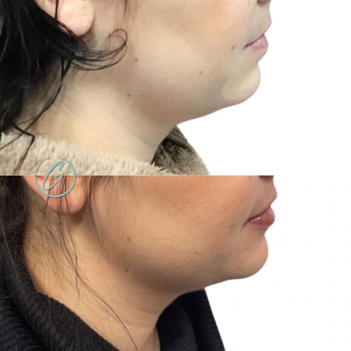 Images Georgous Aesthetic Bar