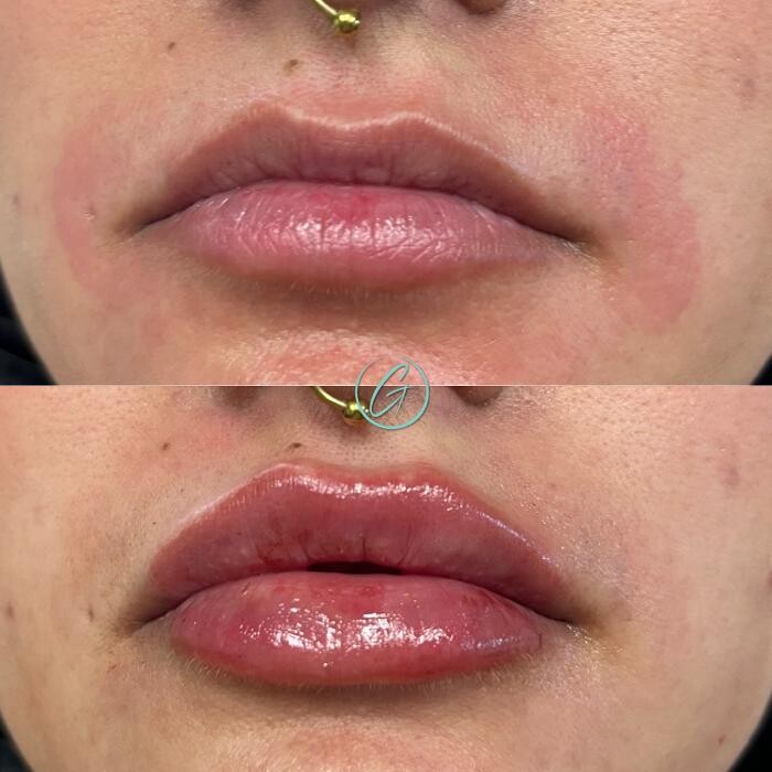 Images Georgous Aesthetic Bar