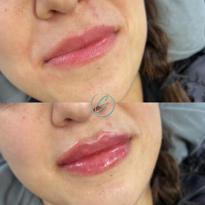 Images Georgous Aesthetic Bar