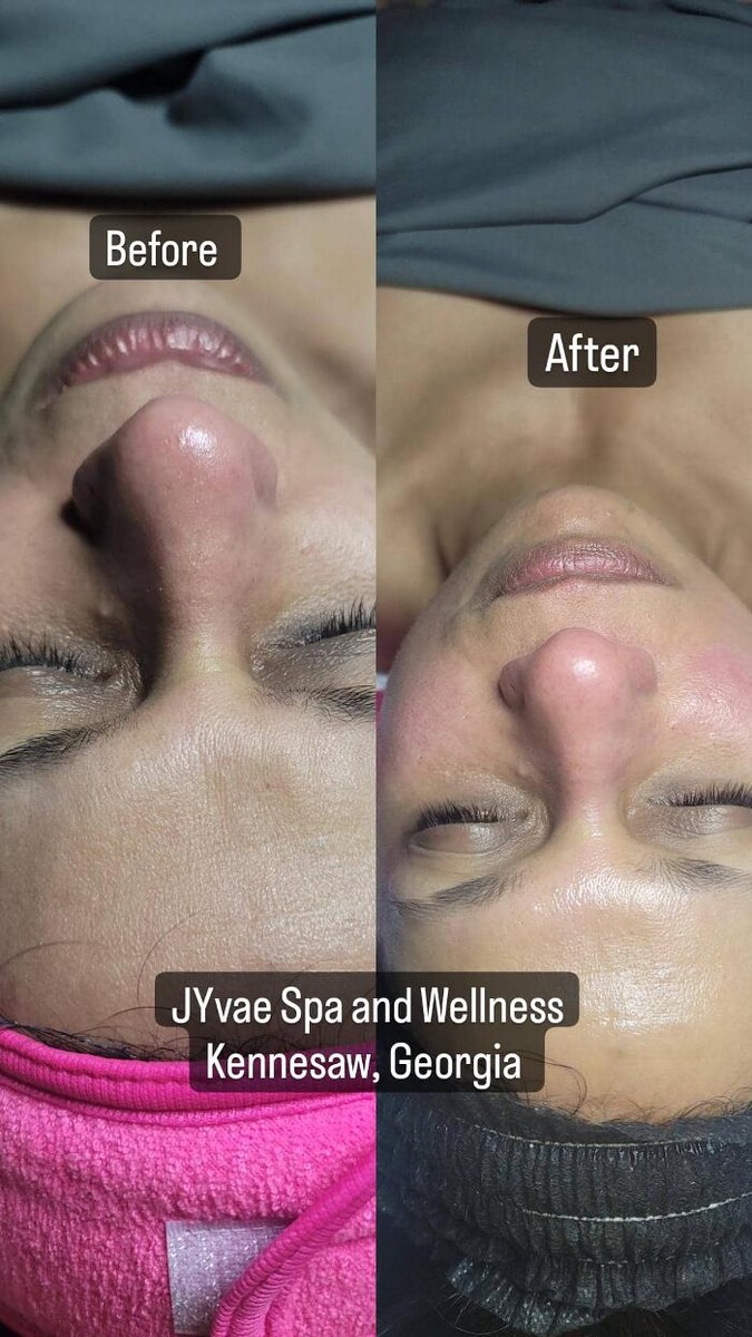 Images JYvae Spa And Wellness