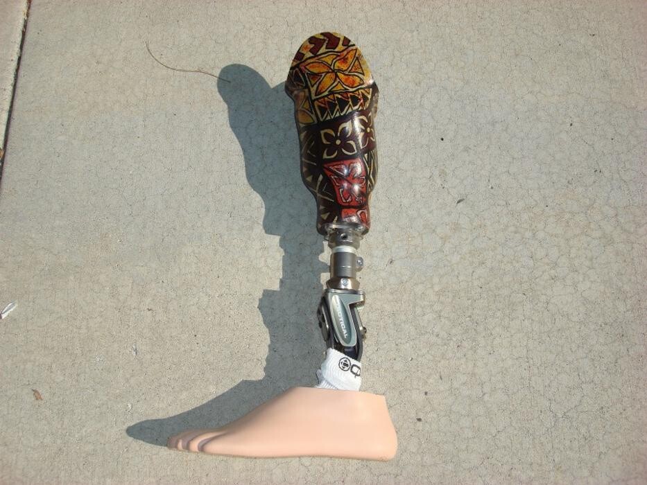 Images Forrester Custom Prosthetics