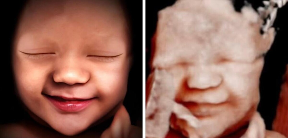 Images Miracle in the Womb