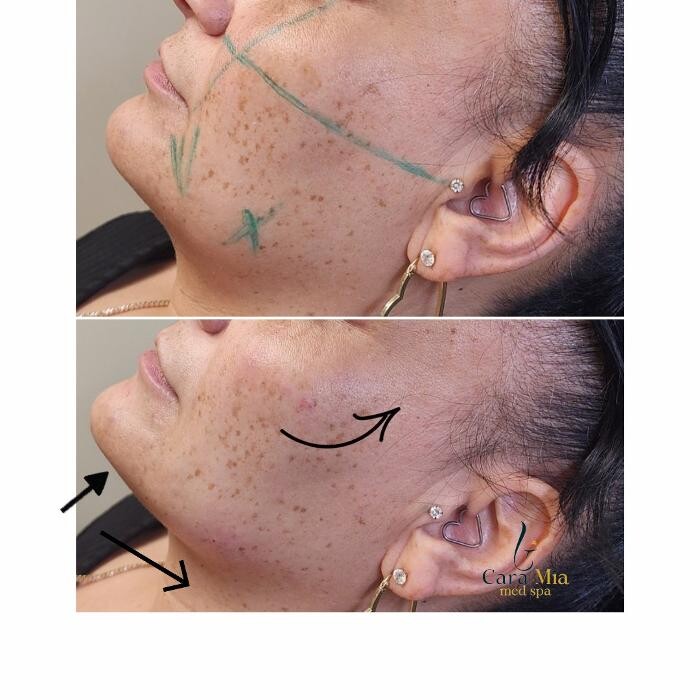 Images Cara Mia Medical Spa