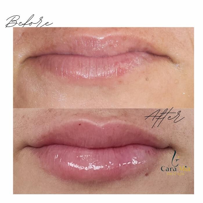 Images Cara Mia Medical Spa