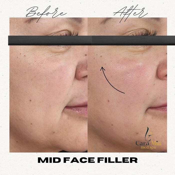 Images Cara Mia Medical Spa