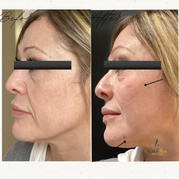 Images Cara Mia Medical Spa