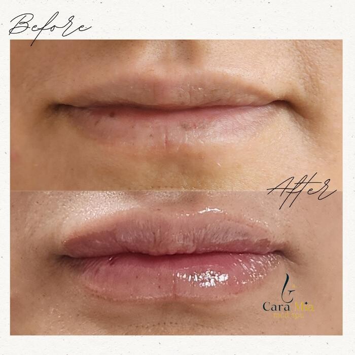 Images Cara Mia Medical Spa