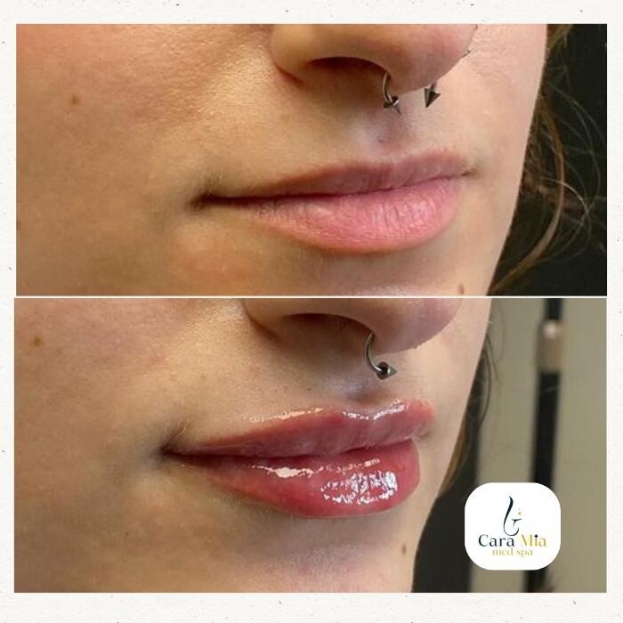 Images Cara Mia Medical Spa