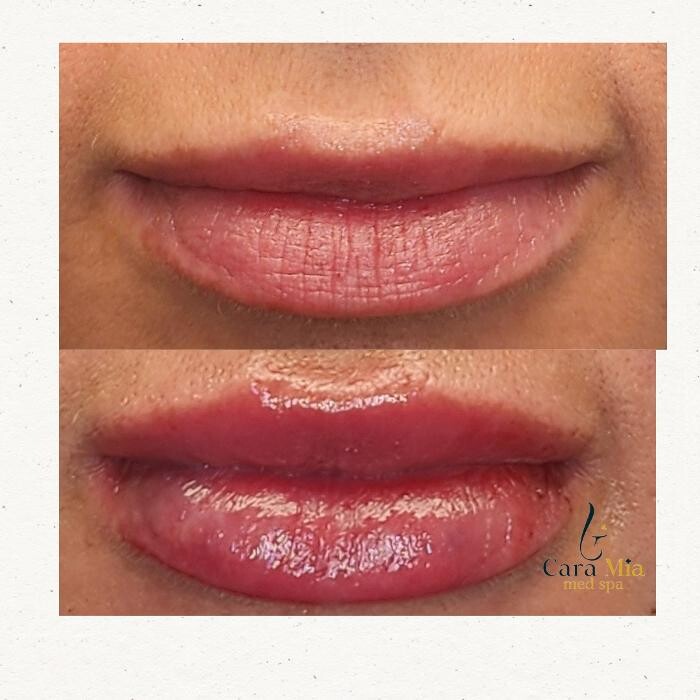 Images Cara Mia Medical Spa