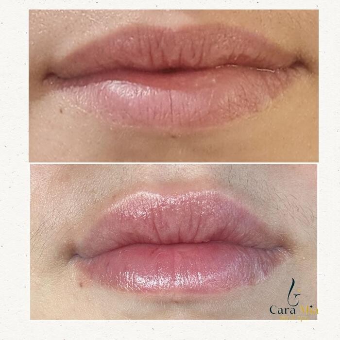 Images Cara Mia Medical Spa