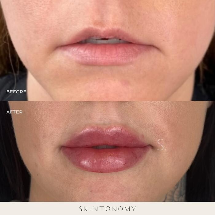 Images Skintonomy Medical Spa