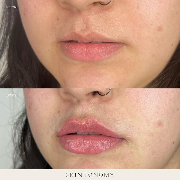 Images Skintonomy Medical Spa
