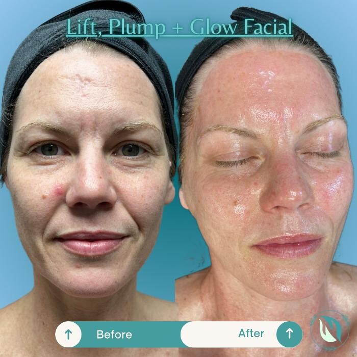 Images NTRL + NAKD SKIN SPA