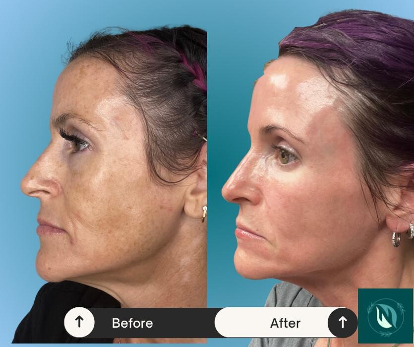 Images NTRL + NAKD SKIN SPA