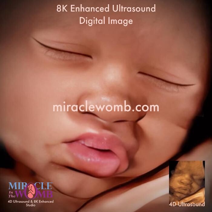 Images Miracle in the Womb