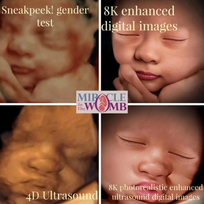 Images Miracle in the Womb