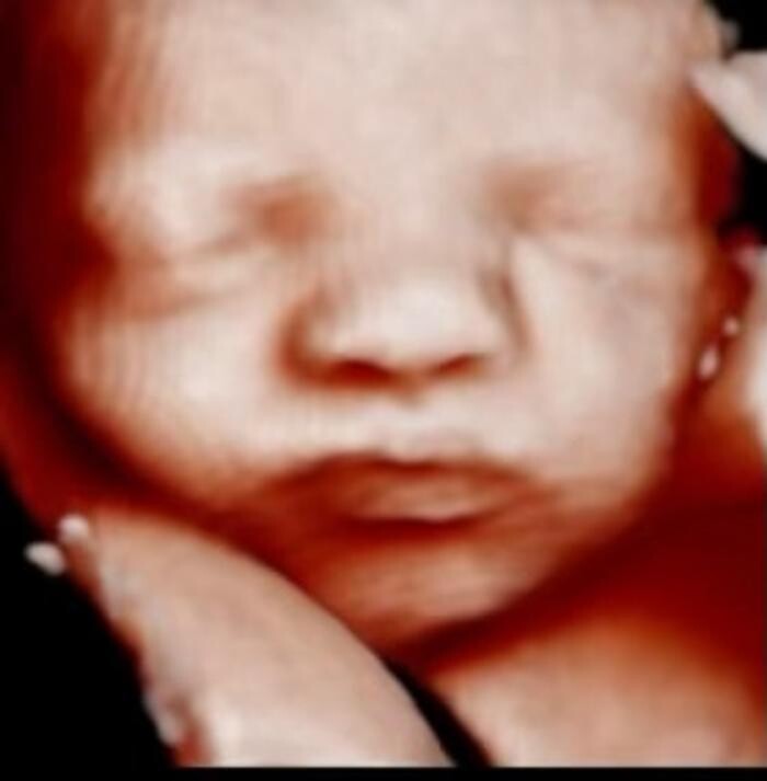 Images Miracle in the Womb