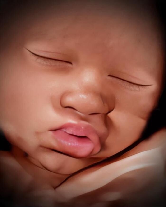 Images Miracle in the Womb