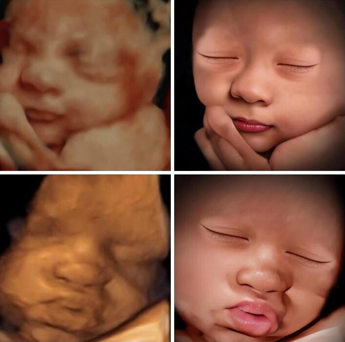 Images Miracle in the Womb