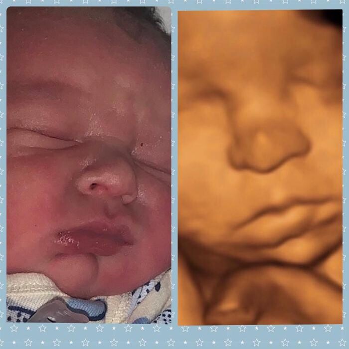 Images Miracle in the Womb