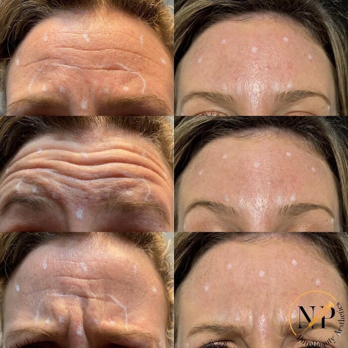 Images PureBeautyNP Aesthetics