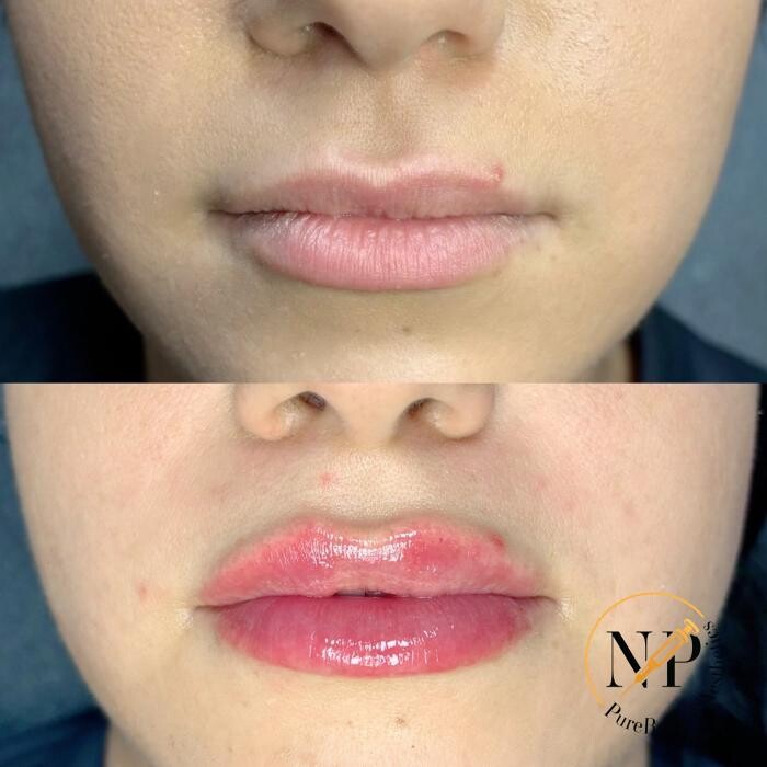Images PureBeautyNP Aesthetics