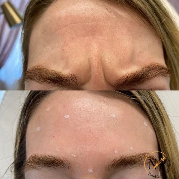 Images PureBeautyNP Aesthetics