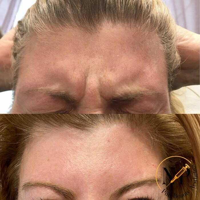 Images PureBeautyNP Aesthetics