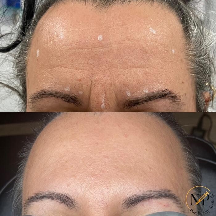 Images PureBeautyNP Aesthetics
