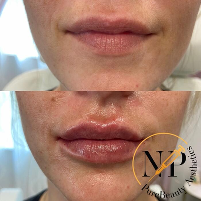 Images PureBeautyNP Aesthetics