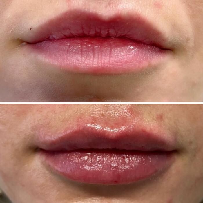 Images PureBeautyNP Aesthetics